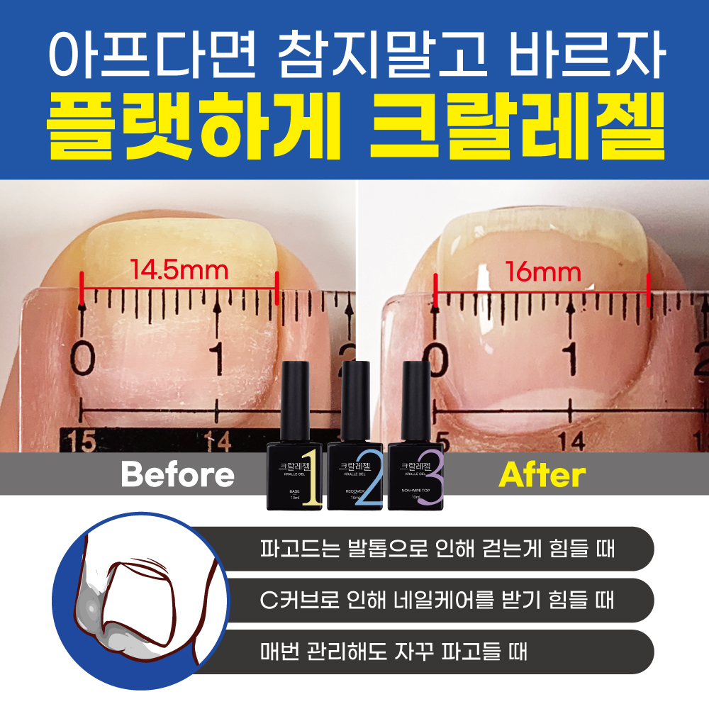 바르면 펴지는 크랄레젤 플랫 베이스젤 발톱 레진젤 발톱관리 이미지 6