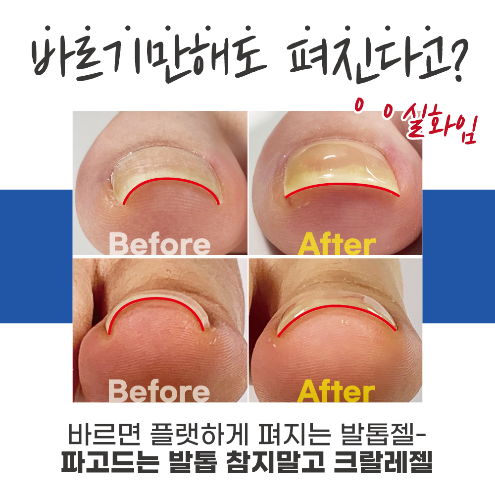 바르면 펴지는 크랄레젤 플랫 베이스젤 발톱 레진젤 발톱관리 - 상세 이미지 3