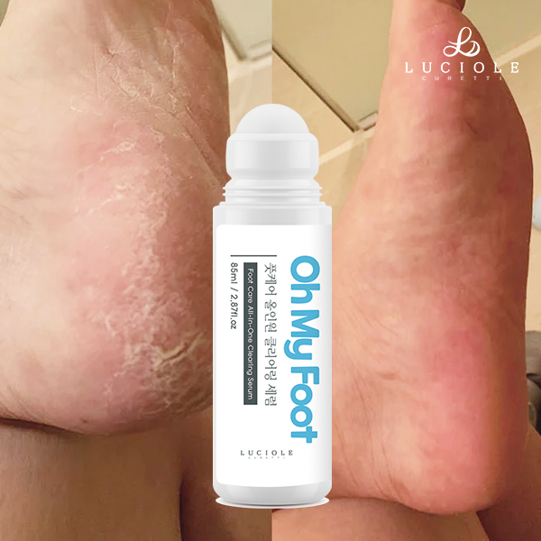 발각질제거제 풋케어 루시올레 오마이풋 발바닥갈라짐 풋세럼 85ml, 1개 - 상세 이미지 4