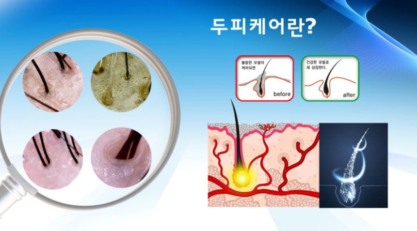 퀸케어두피클리닉 이미지