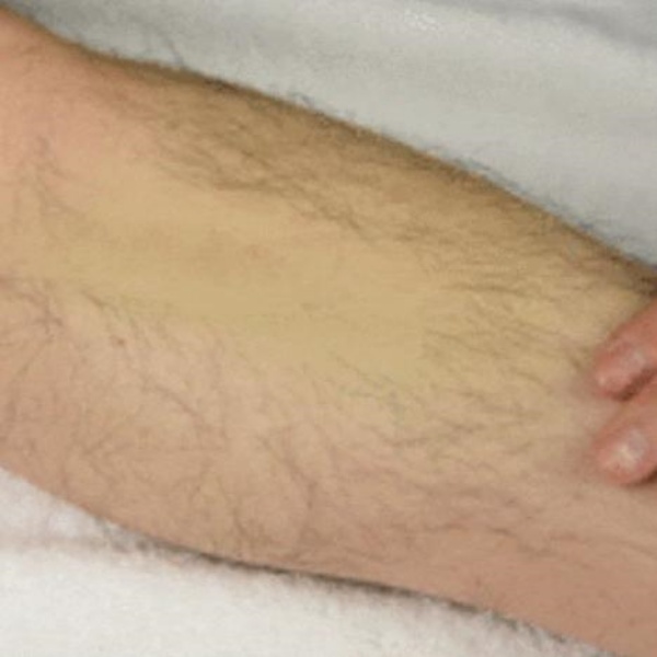 셀프왁싱 비키니라인 겨드랑이 종아리 남자 다리털 수염 가슴털 제모 왁싱 테이프 크림 - 상세 이미지 3