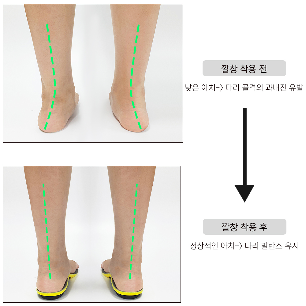 발편한 아치 오다리 평발 교정 깔창 키높이 운동화 안전화 깔창 이미지 2