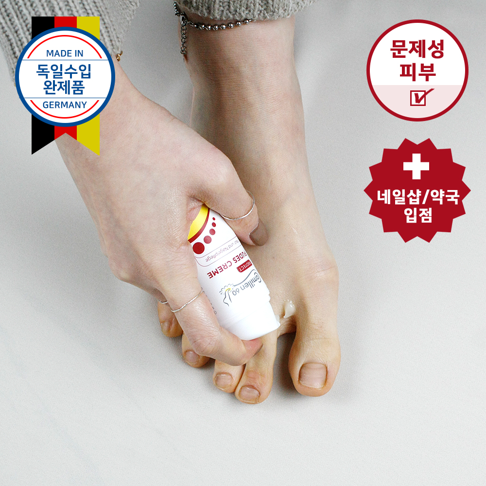 독일 카밀렌60 FUDES 푸데스 크림 문제성손발톱 발가려움 30ml - 상세 이미지 2