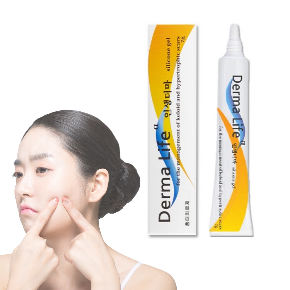 여드름 흉터 연고 수술 화상 인생더마 7g 켈로이드 더마라이프