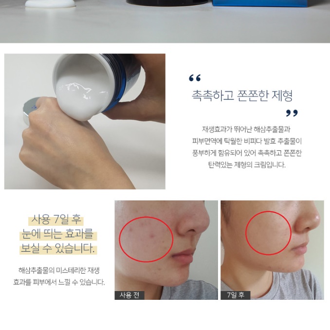 효과 좋은 물광 크림 해삼크림 순한 겨울 수분 크림 - 상세 이미지 3
