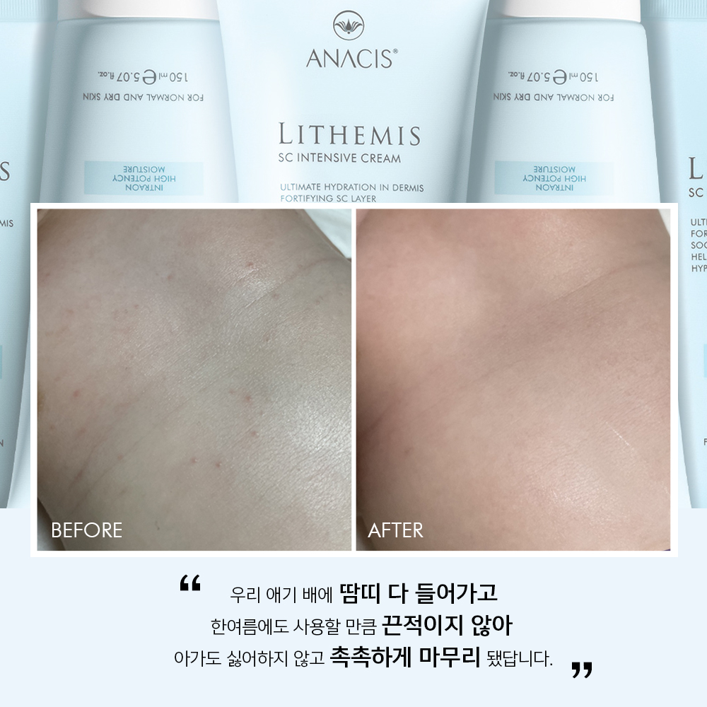 리더미스 고보습 피부장벽 세라마이드 덱스판테놀 속건조 악건성 수분 크림 4개 - 상세 이미지 2