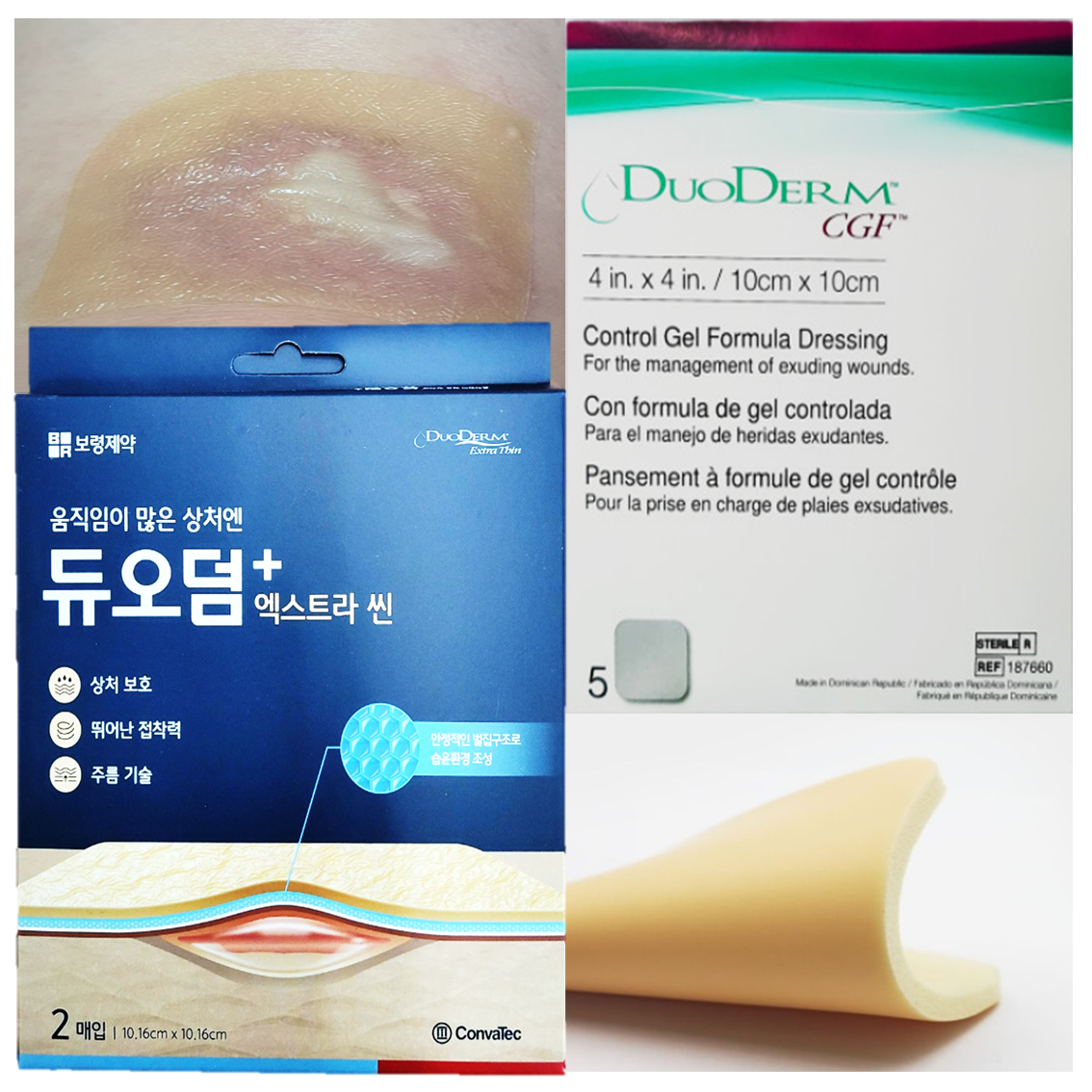 듀오덤 CGF 10x10cm 5매 상처 화상 욕창 진물 두꺼운 습윤밴드 - 상세 이미지 4