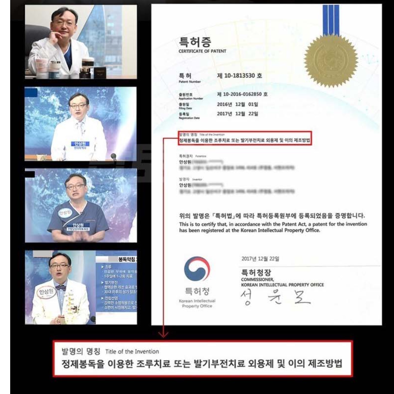 남자 전립선 크림 남성 봉독크림 봉침 벌독 크림 - 상세 이미지 4