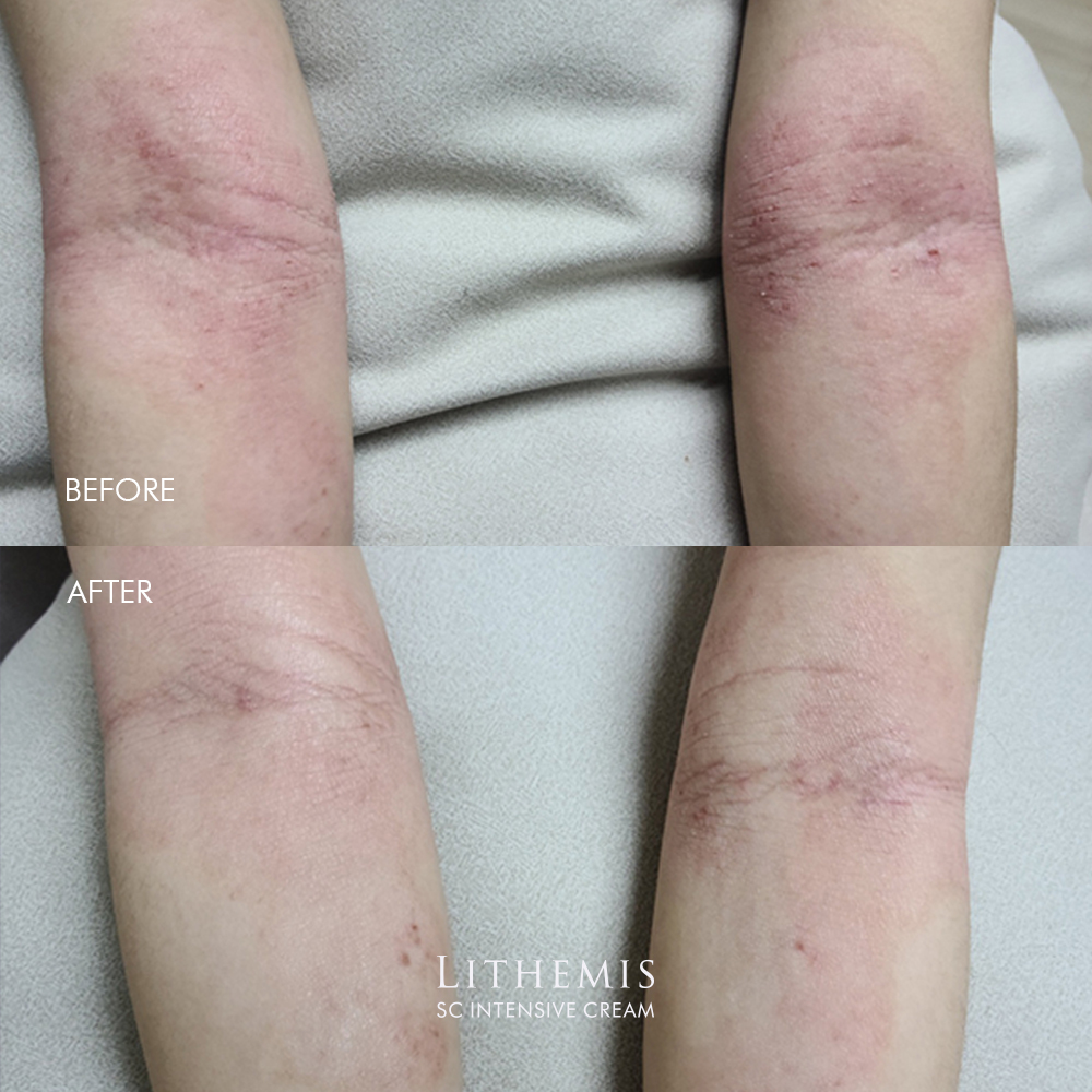 리더미스 고보습 피부장벽 세라마이드 덱스판테놀 속건조 악건성 수분 크림 4개 이미지 7