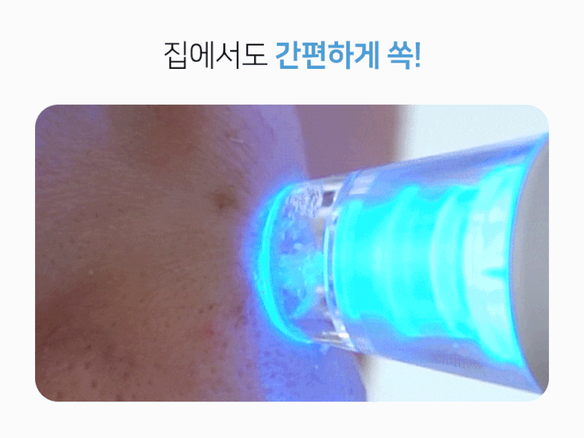 펄케어 피지 압출기 흡입기 블랙헤드 제거기 판매처 상세 정보 이미지 4