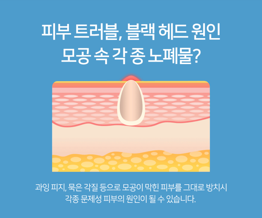 펄케어 피지 압출기 흡입기 블랙헤드 제거기 판매처 상세 정보 이미지 2