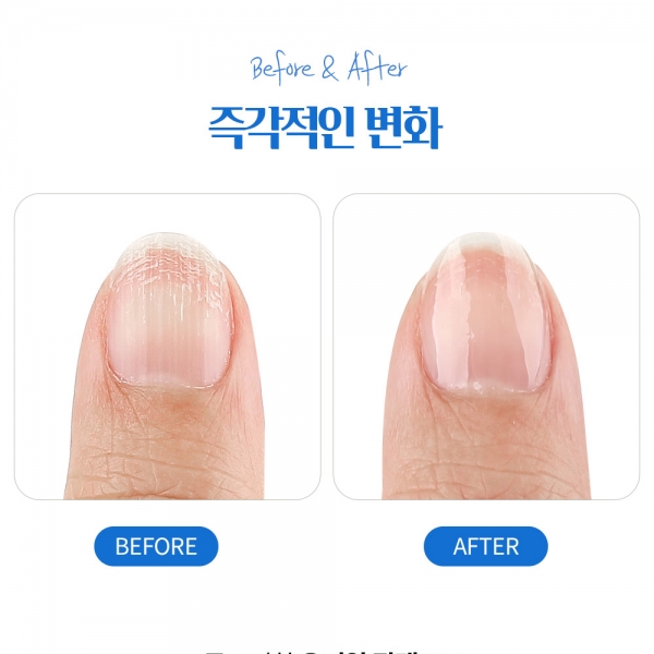 루핀 네일하드너15ml 손톱 발톱 케어 세로줄 네일영양제 강화제 - 상세 이미지 3