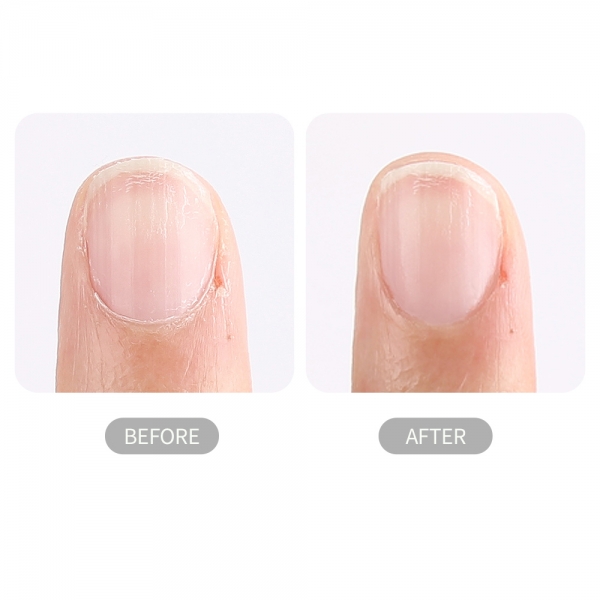 루핀 큐티클리무버 15ml 젤 네일 큐티클관리 - 상세 이미지 3