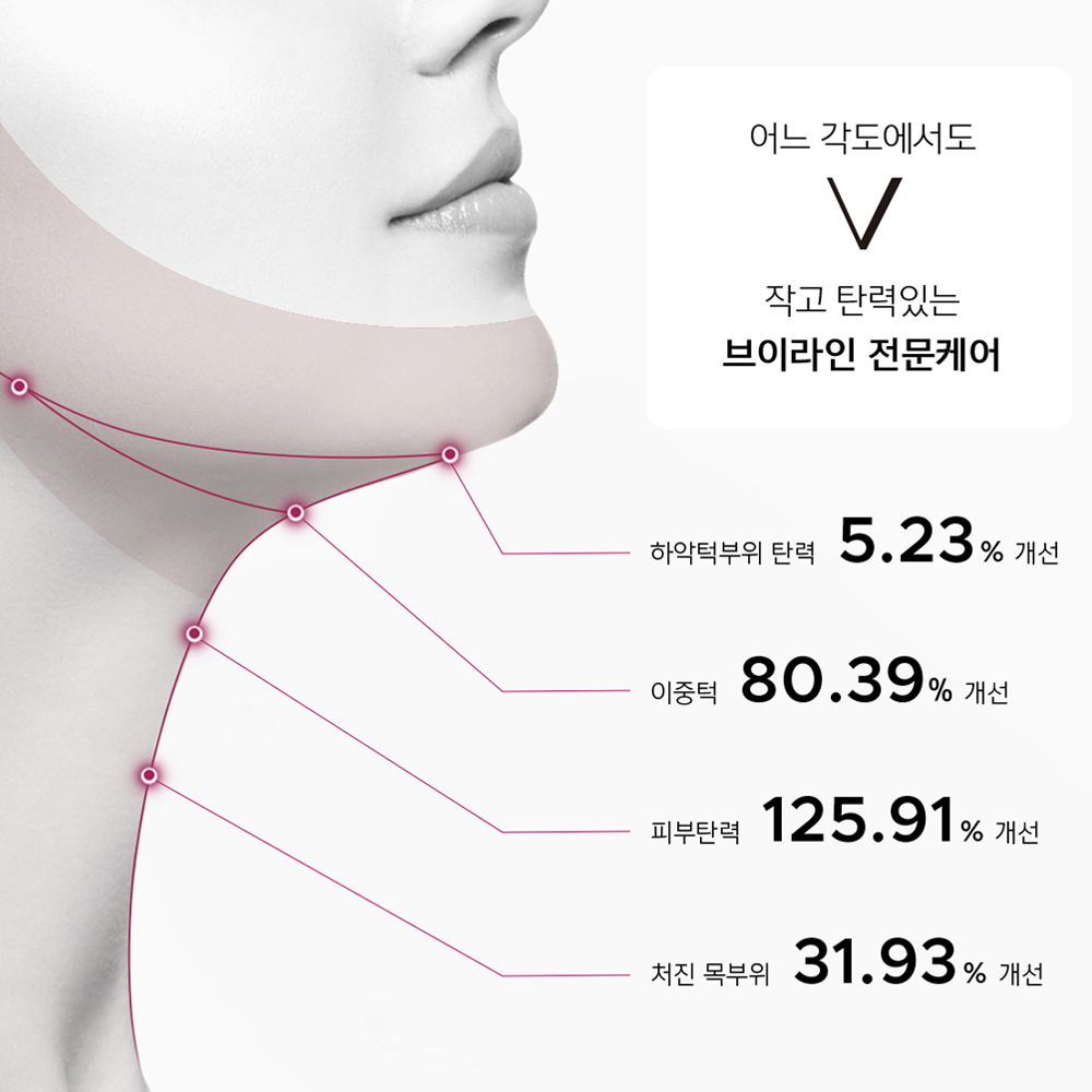 벨라컨투어 얼굴 윤곽관리 처진턱살 땡기미 볼살 안면 심부볼 턱선 처진얼굴 리프팅 2종 이미지 6