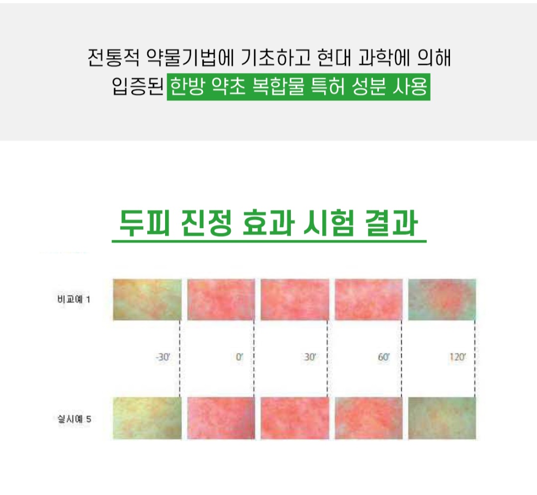 편백 샴푸 약산성 민감성 건성 비듬 각질 두피케어 가려움 지루성 정수리냄새 아토러브 - 상세 이미지 5