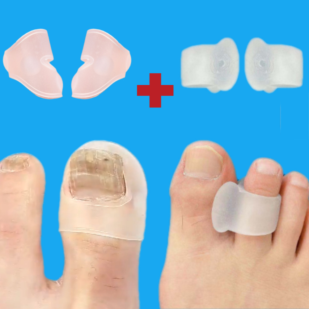 닥터토우 내성발톱 테이핑 보호밴드 실리콘 테이프 셀프관리