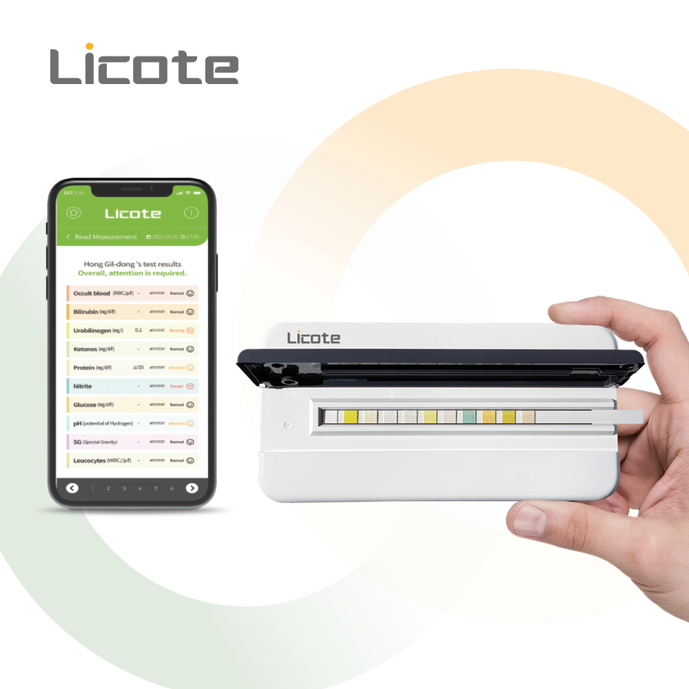 인체전용 소변검사기 단백뇨측정기 분석기 당뇨고혈압 리코테자가진단 NA23