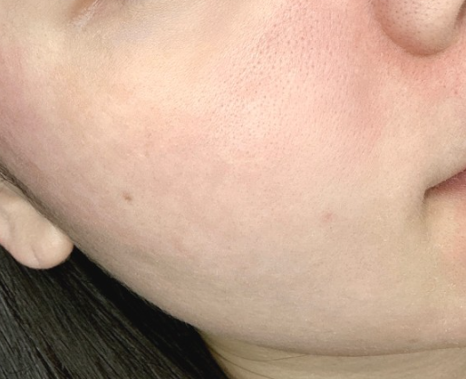 ONGREDIENTS Fresh Soothing Cream - description 2