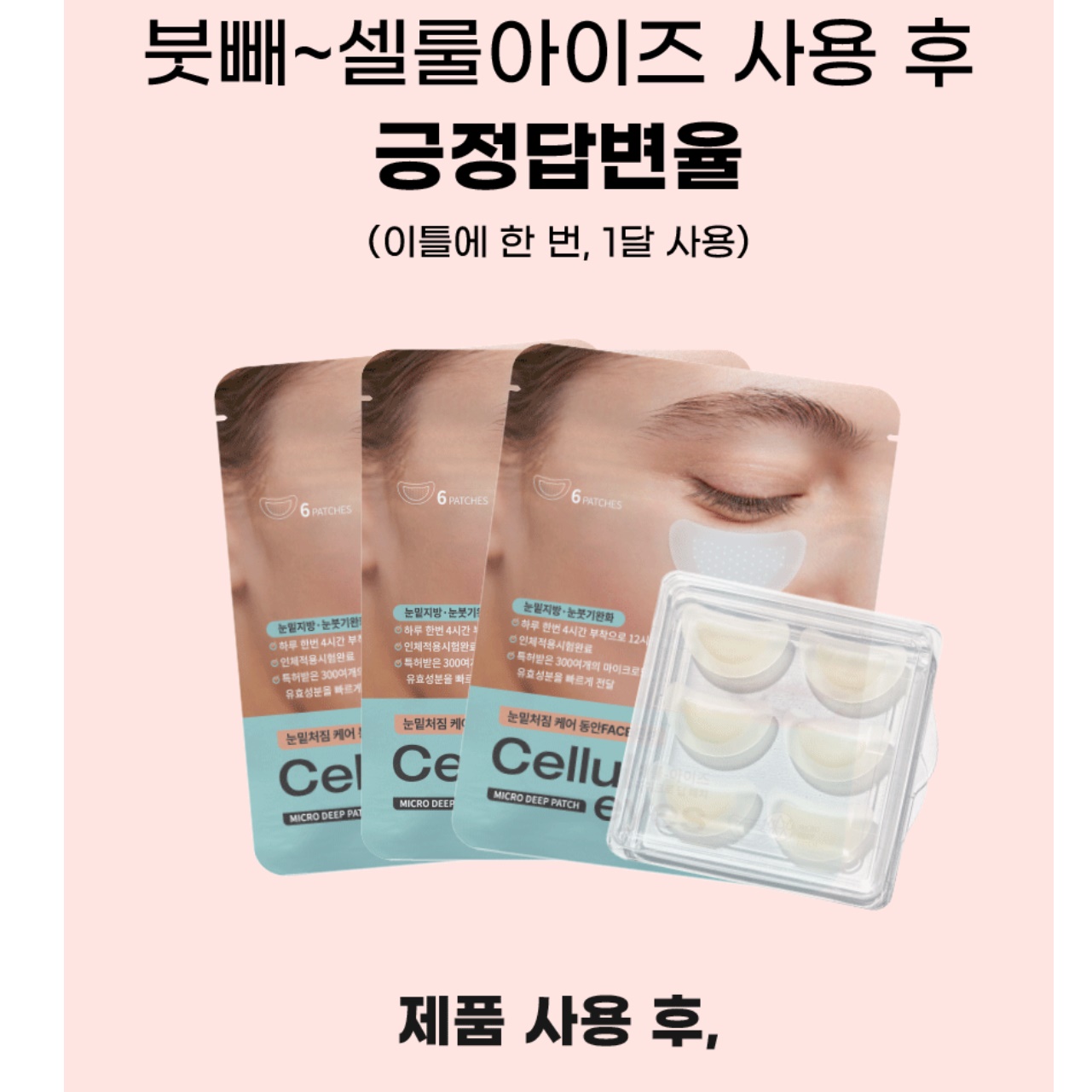 마이크로딥 니들 눈밑테이프 눈가 히알루론산 눈밑패치 - 상세 이미지 5