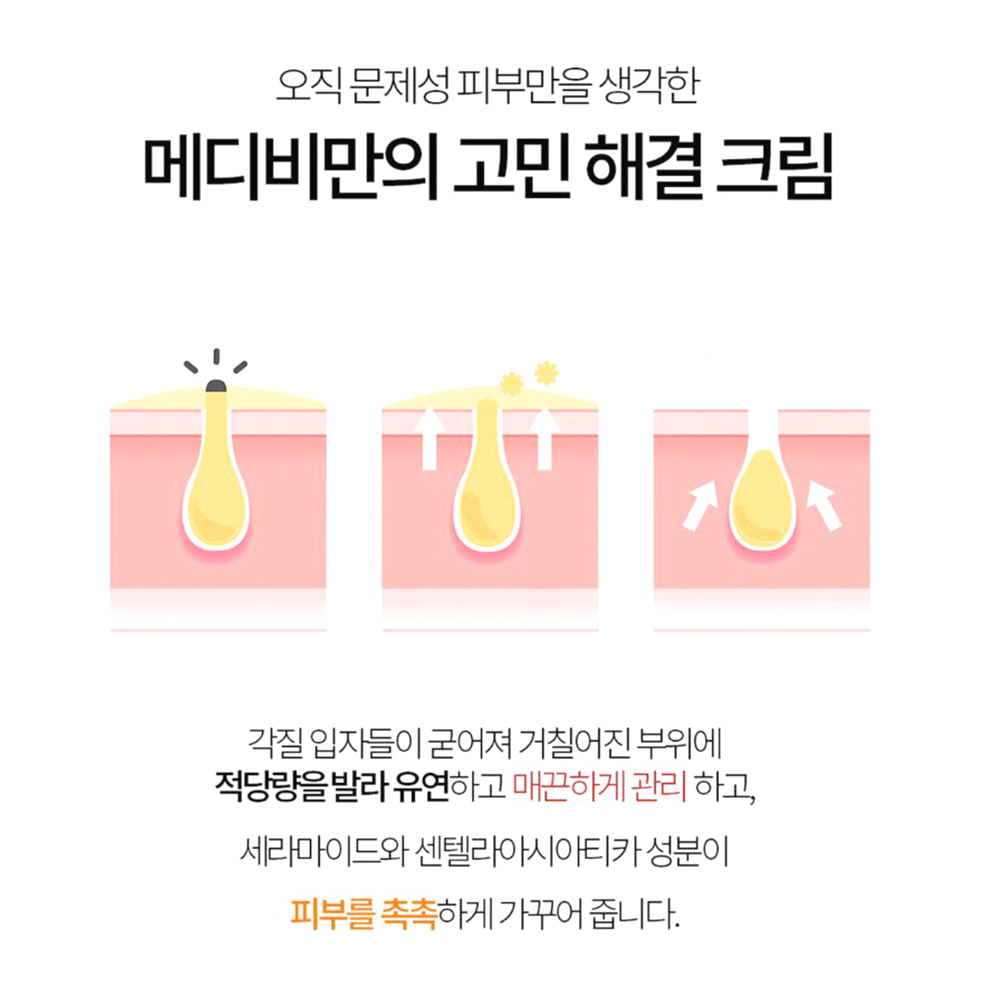 피부 비립종 제거크림 사마귀 얼굴 목 겨드랑이 눈밑오돌토돌 좁쌀 재생 연고 - 상세 이미지 5