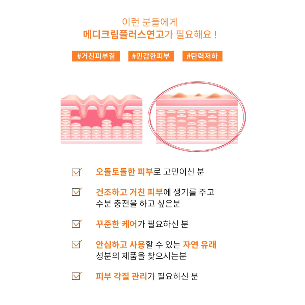 피부 비립종 제거크림 사마귀 얼굴 목 겨드랑이 눈밑오돌토돌 좁쌀 재생 연고 - 상세 이미지 2