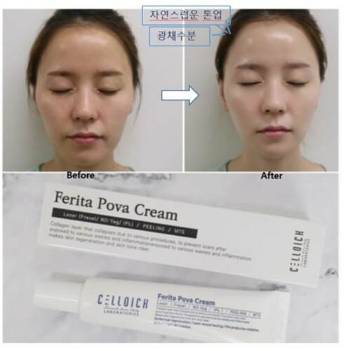 셀디치 페리타 포바크림 25ml 증정품 - 상세 이미지 5