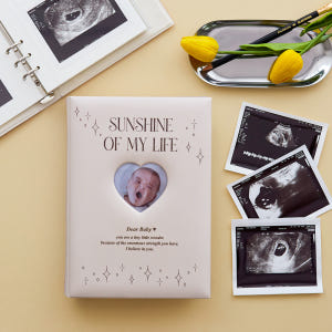 초음파앨범 아기 사진앨범 접착식 포토북 각인 스티커세트 실사용 후기 | 효과 있을까? - 상품 이미지 1