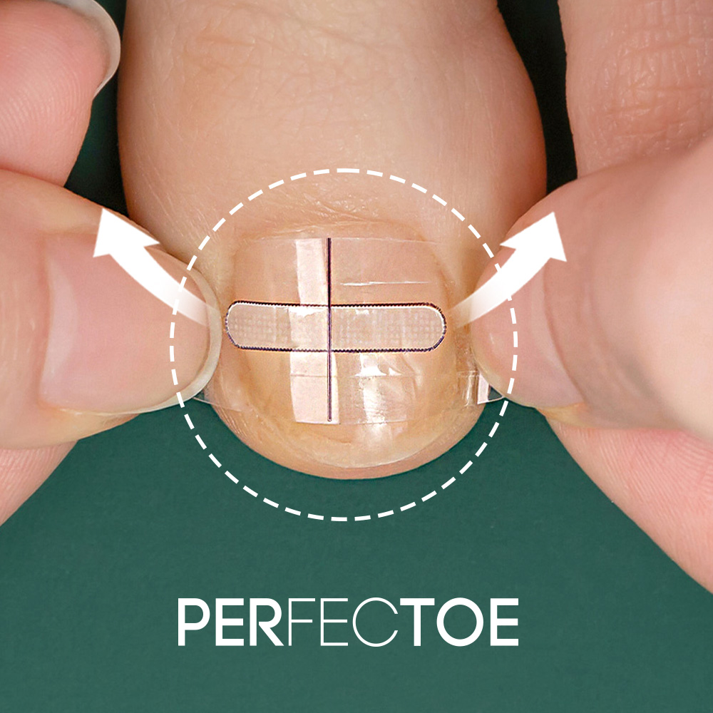 퍼펙토 내성발톱 교정기 스트립 팁 의료기기 20매 세트 파고드는발톱 교정팁 테이프 제품 이미지