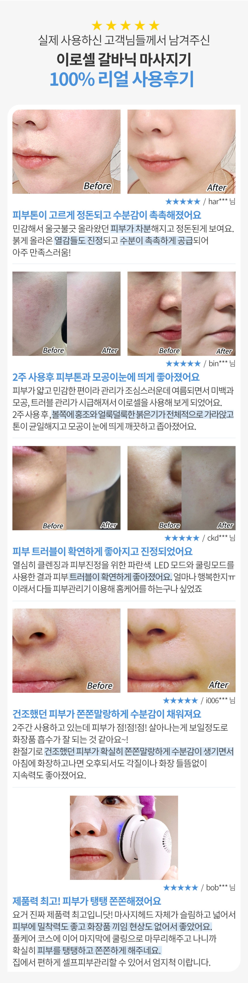 이로셀 갈바닉 마사지기 고주파 홈케어 디바이스 쿨링 갈바닉 부스터 판매처 상세 정보 이미지 2
