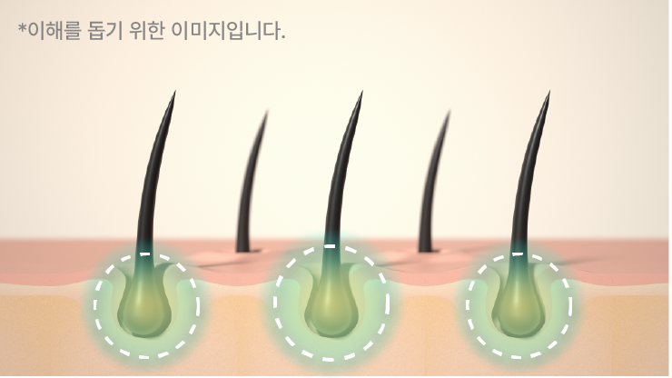 [행사상품] 벤스랩 비엘모 두피토너 대용량 120ml, 3+1 행사(탈모완화 기능성)