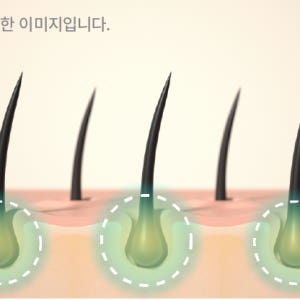 [행사상품] 벤스랩 비엘모 두피토너 대용량 120ml, 3+1 행사(탈모... 솔직 후기 | 피부 타입별 분석 - 상품 이미지 4