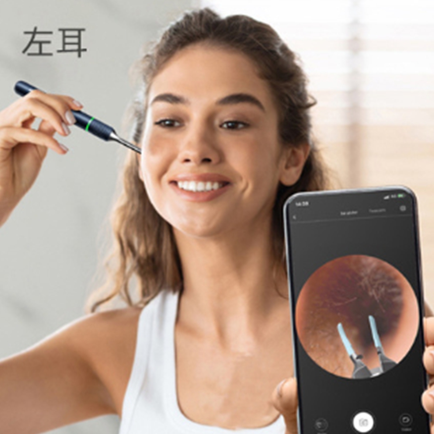 핀셋형 고급 귀지청소기 귀이개 귀지제거기 귓밥제거기 bebird Note5 이미지 8