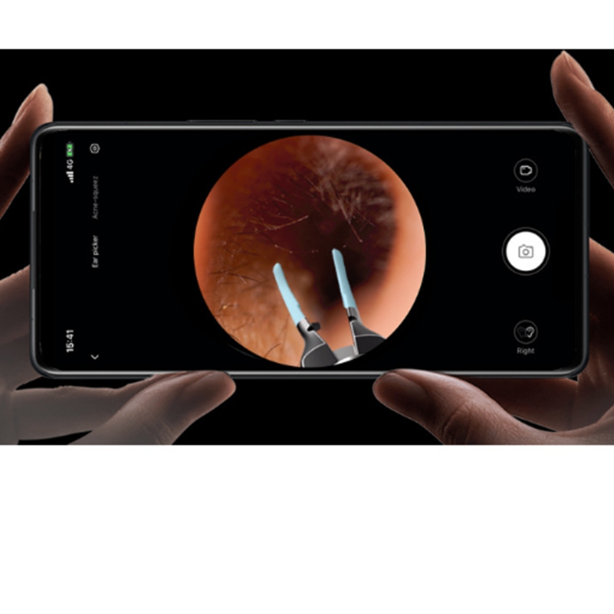 핀셋형 고급 귀지청소기 귀이개 귀지제거기 귓밥제거기 bebird Note5 - 상세 이미지 4