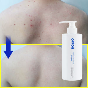 오프온 등드름 보습 바디워시 천연 퍼퓸 등여드름 가드름 남자여자 체취오래... 솔직 후기 | 피부 타입별 분석 - 상품 이미지 4