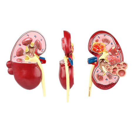 병원 내과 상담용 신장질환 해부모형 과학캠프 교실꾸미기 초등 엄마표 집콕놀이 세특