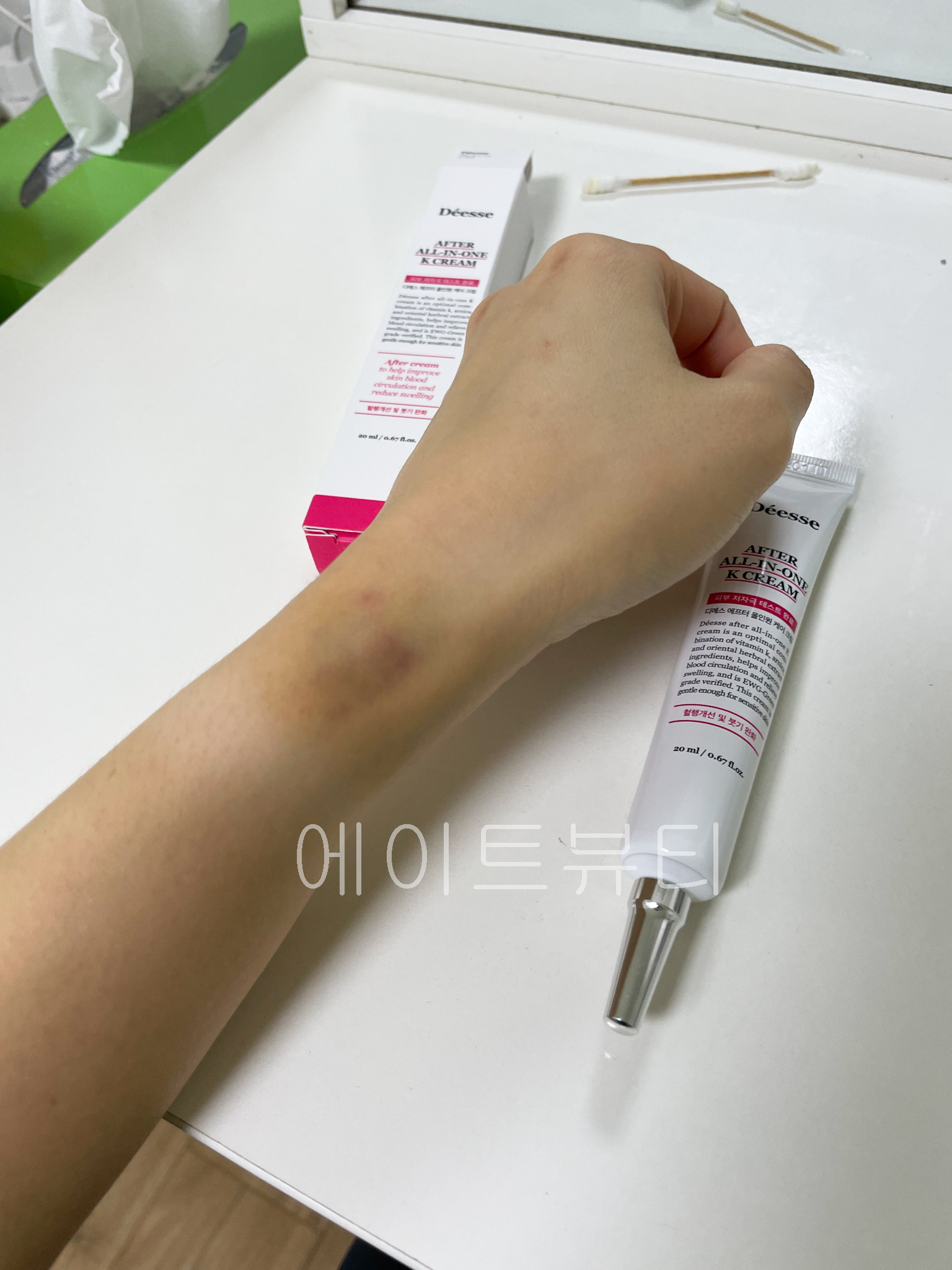 디에스 애프터 올인원K 성형붓기수분진정 혈행개선 아르니카 비타민k 인모드 20ml, 1개 - 상세 이미지 5