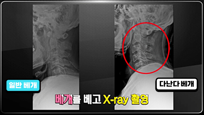 높이조절 경추베개 메모리폼 목이편한 기능성 수면 다난다 C커브 맞춤 베개 특허 이미지 8