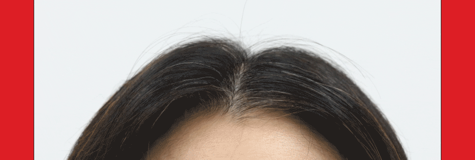 DR.FORHAIR Folligen Bio-3 Shampoo - details 9