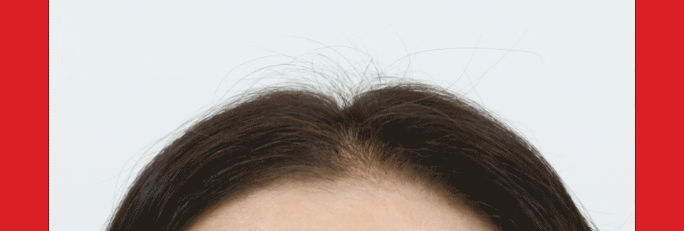 DR.FORHAIR Folligen Bio-3 Shampoo - details 7