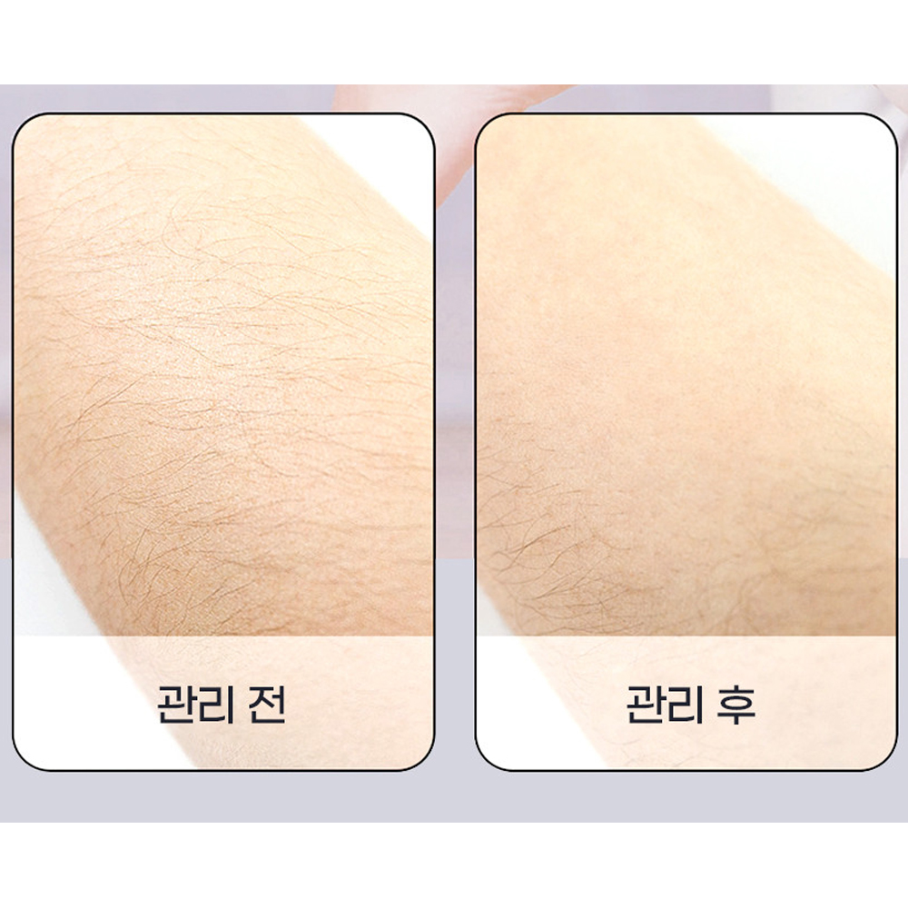 늘바론 털없수다 바디쉐이버 제모패드 이미지 2