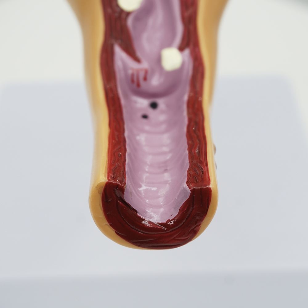 여성 생식기 모형 여자 해부학 인체 해부 자궁 신체 이미지 6