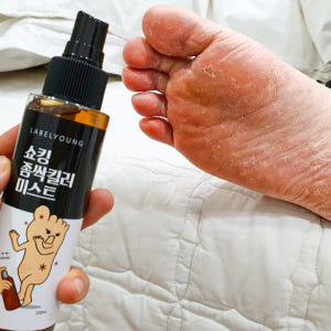 라벨영 각종발고민,문제성발 집중케어/풋미스트/쇼킹좀싹킬러미스트 솔직 후기 | 피부 타입별 분석 - 상품 이미지 2