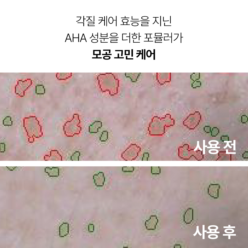 이니스프리 수퍼 화산송이 모공 마스크 100mL - 상세 이미지 5