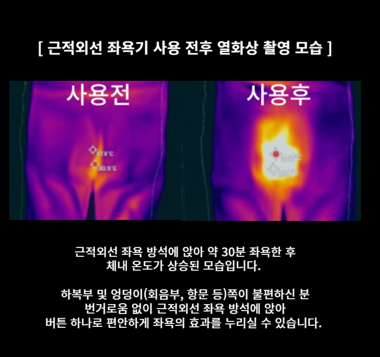 근적외선 좌욕기 치질 방석 건식 질염 좌욕 전립선 적외선 좌욕기 - 상세 이미지 5