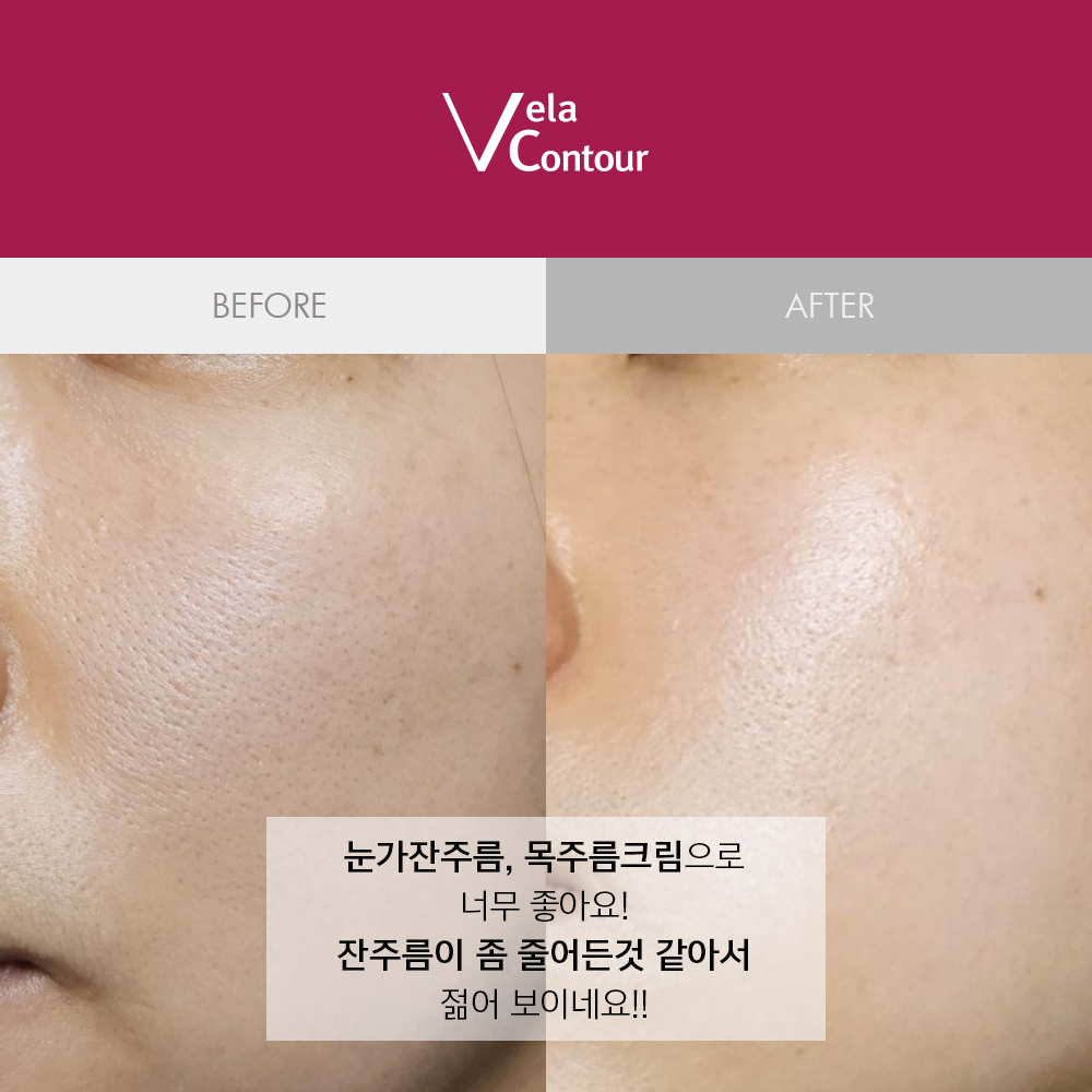 벨라컨투어 퍼밍 바르는 콜라겐 주름개선 크림 30ml - 상세 이미지 3