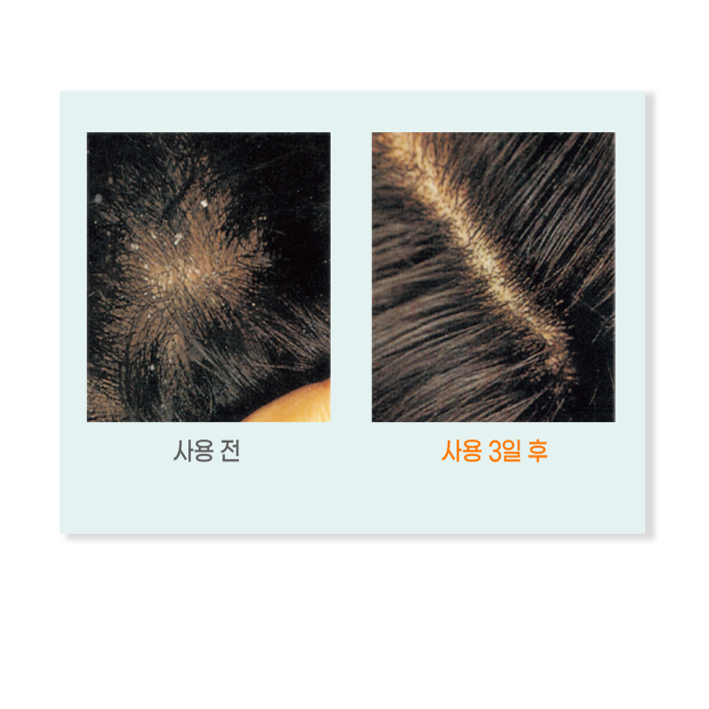 스킨캡 샴푸 건조함 완화 두피트러블 감소 프랑스 150ml용량 1+1이벤트 - 상세 이미지 3