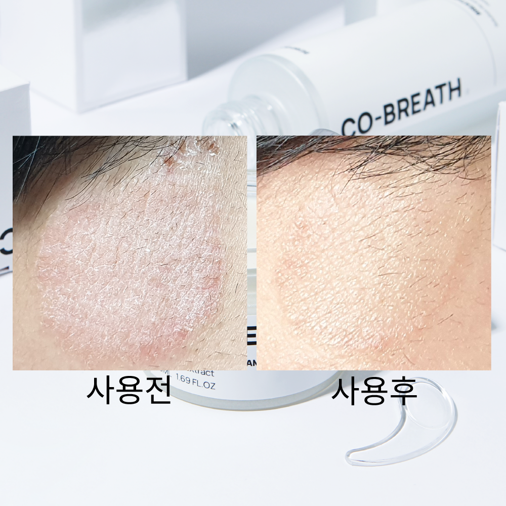 [넾다세일] 코브리드 베리붐 수분장벽 보습크림 50ml [나이아신아마이드, 세라마이드 세콜지 환절기 건조 촉촉 피부 저속노화 수분크림 악건성 푸딩 코코베리] 24년12월20일 제조 - 상세 이미지 2