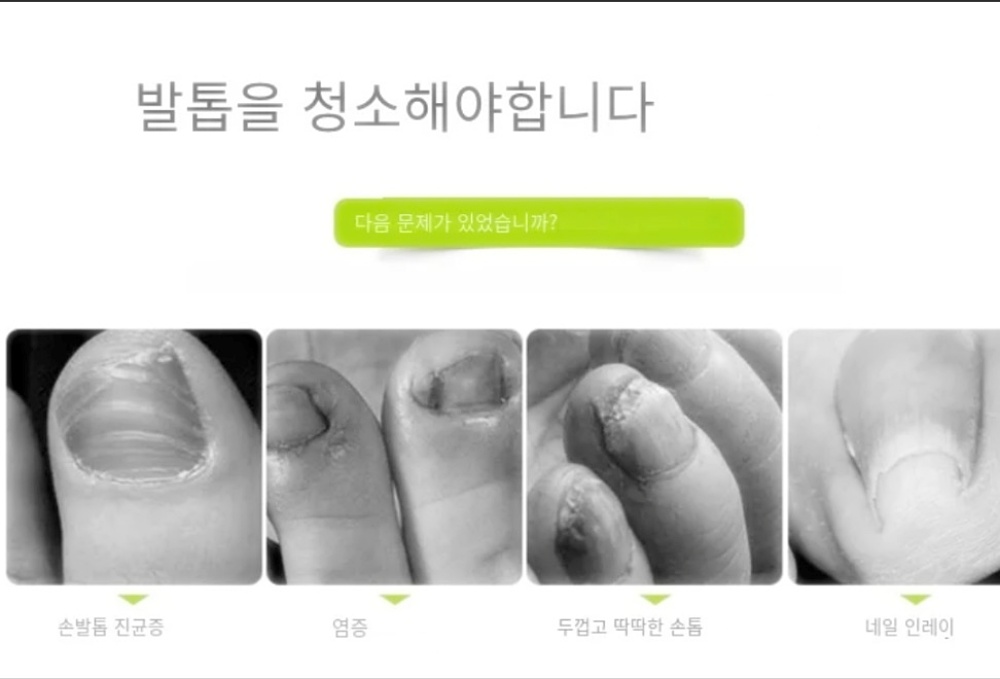 내성발톱 컷팅 니퍼 두꺼운 발톱 와이어커팅 고급형 박대표마켓 이미지 6