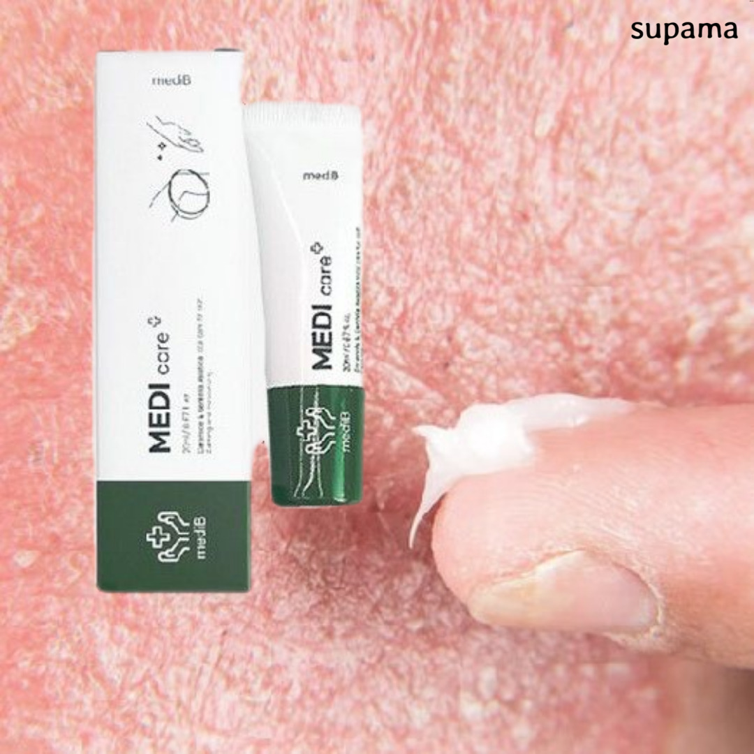 피부 가려움증 오돌토돌 붉은반점 연고 약 노인성 간지로움 원인 곰팡이균 - 메인 이미지