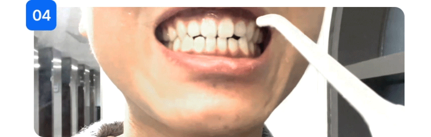 구강세정기 > 오늘의딜 특별가! 치과공식판매 구강세정기 물치실 휴대용 수압 6단계 V2 화이트 | 오늘의집 쇼핑 오늘의딜 특별가! 치과공식판... 